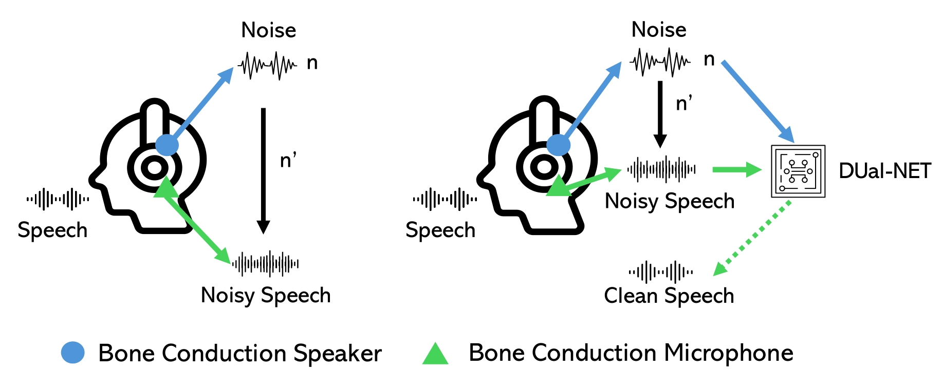 DUal-NET: A Transformer-Based U-Net Model for Denoising Bone Conduction Speech