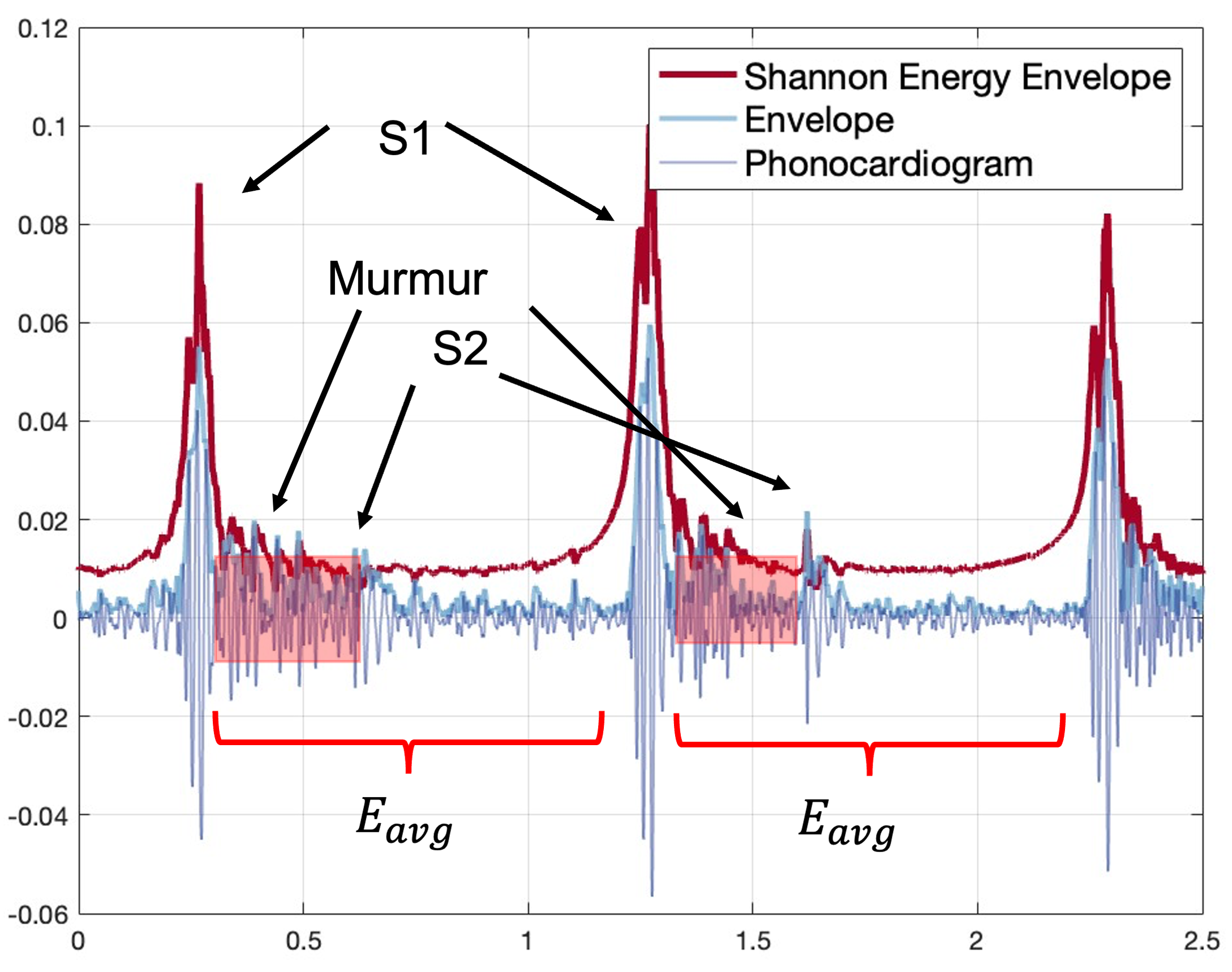 Audio processing from stethoscope to search for fine-grained auscultation locations, much like how doctors use their ears.